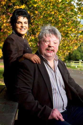 Simon Weston